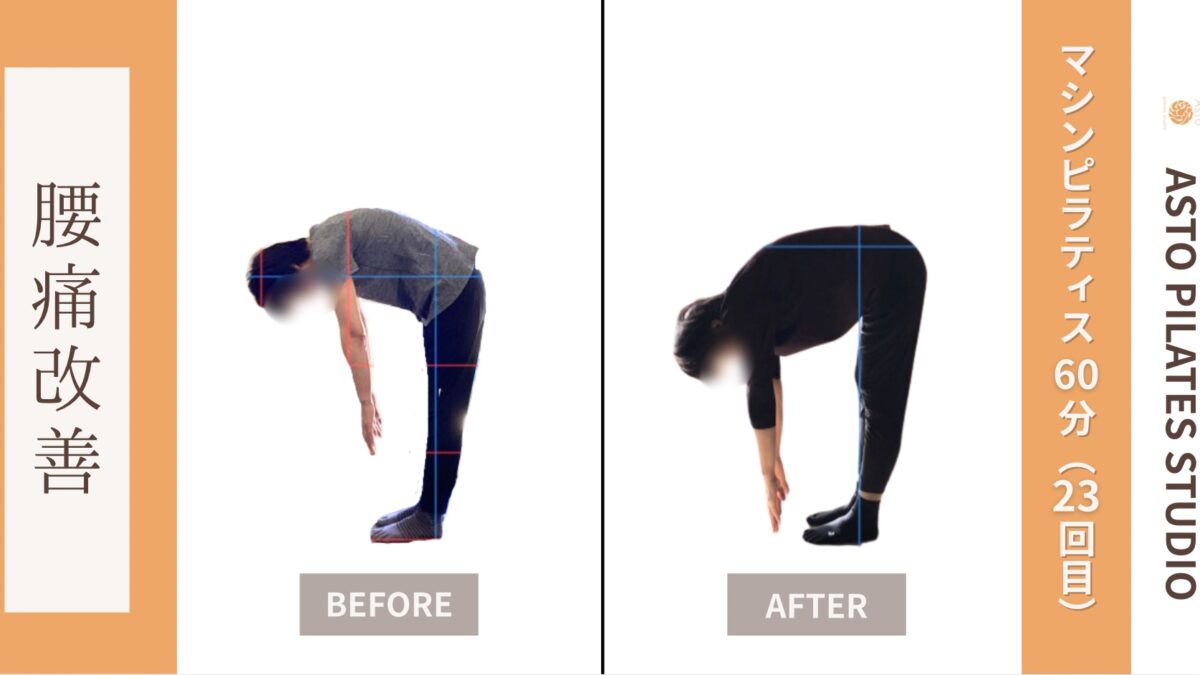 【腰痛改善】倉敷ピラティスで痛みのない生活へ